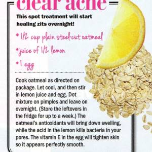 12 DIY Acne Treatments That Will Save Both Your Money And Your Skin