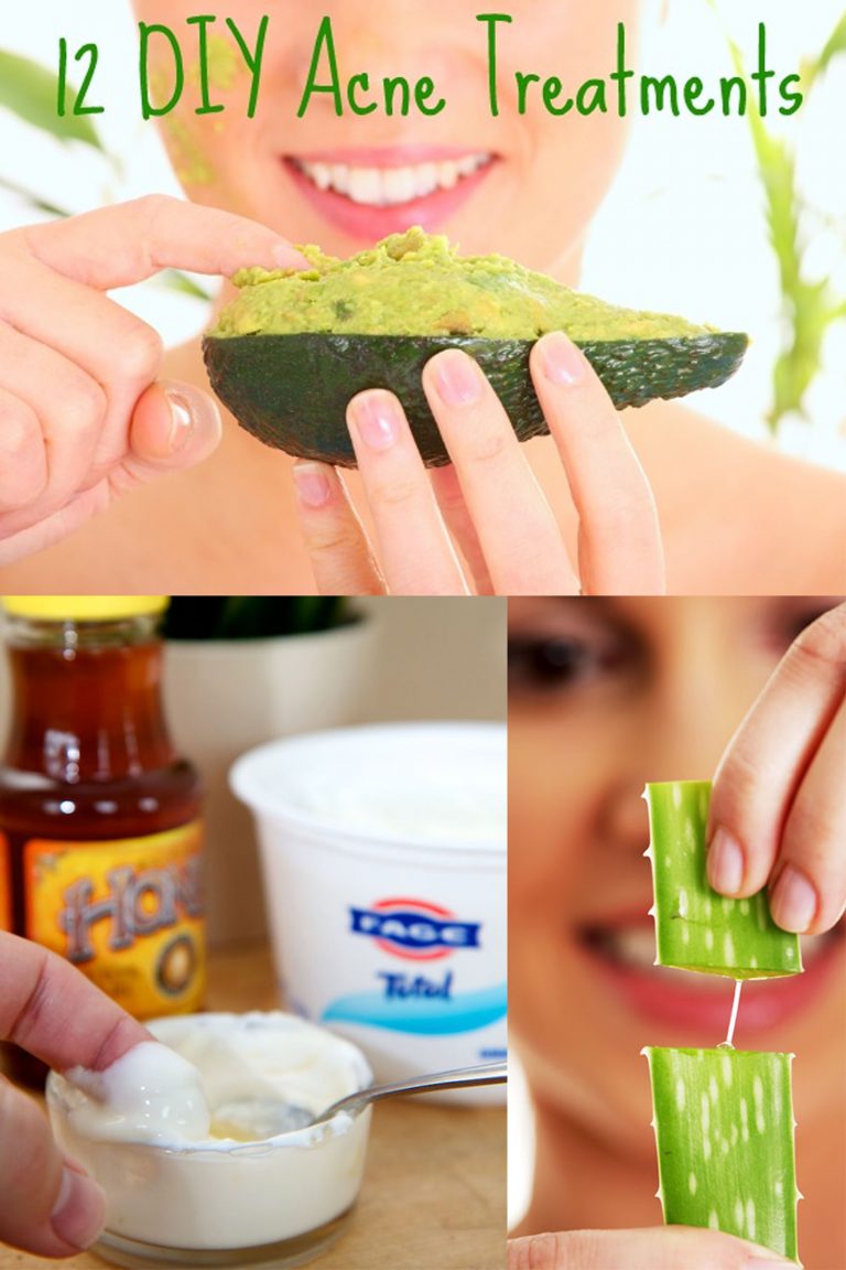 12 Diy Acne Treatments That Will Save Both Your Money And Your Skin How To Do Easy