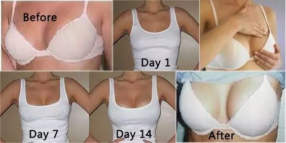 Massage Your Breasts With THIS To Make Them Firm And Perky In Just 2 Weeks