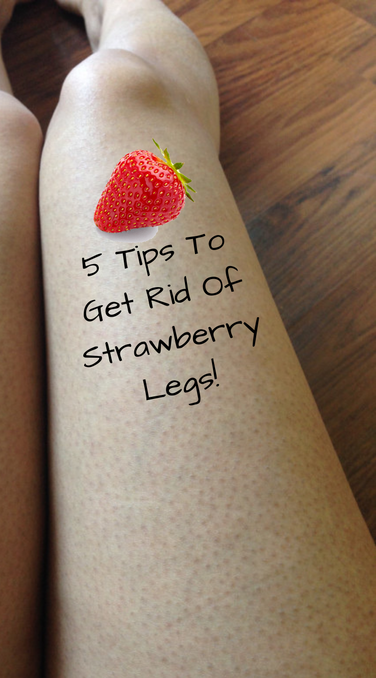 5 Tips To Get Rid Of Strawberry Legs!